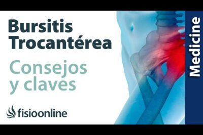 Tratamiento y Prevención Efectiva para la Troncanteritis: Guía Completa