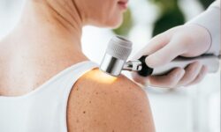 Especialistas en el Cuidado de tu Piel con dermatólogos en Talca