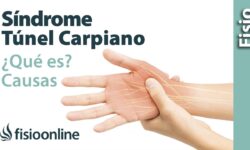 ¿Qué es el síndrome del túnel carpiano y cómo tratarlo?